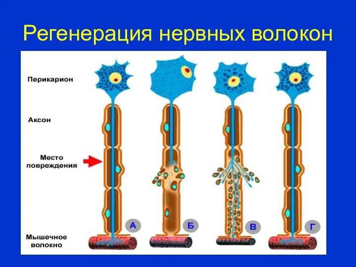 Регенерация нервных волокон