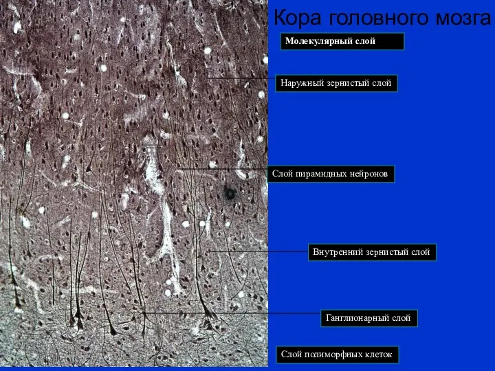 Ганглионарный слой Внутренний зернистый слой Кора головного мозга Слой пирамидных