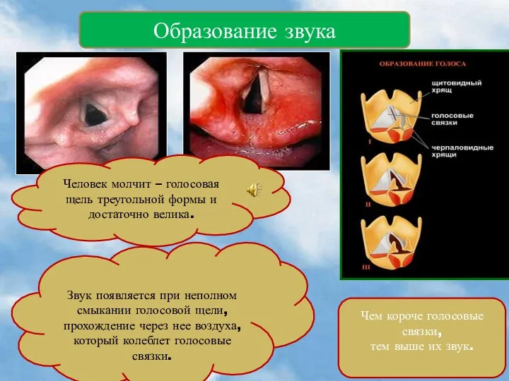 Образование звука Человек молчит – голосовая щель треугольной формы и