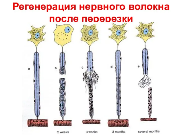 Регенерация нервного волокна после перерезки