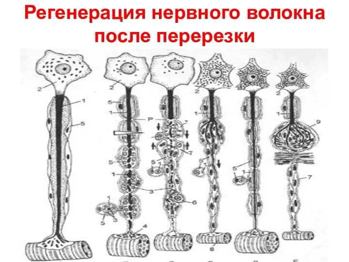 Регенерация нервного волокна после перерезки