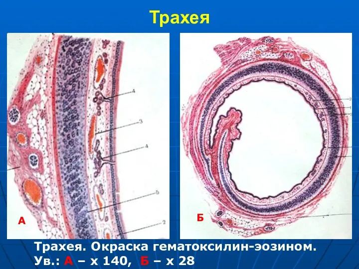 Трахея А Б Трахея. Окраска гематоксилин-эозином. Ув.: А – х 140, Б – х 28