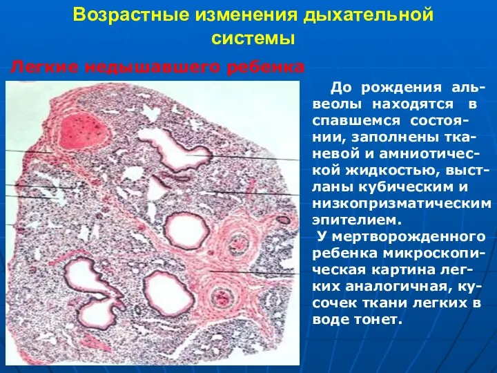 Возрастные изменения дыхательной системы Легкие недышавшего ребенка До рождения аль-веолы находятся в спавшемся