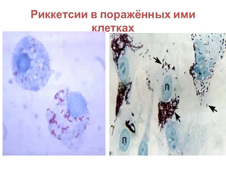 Риккетсии в поражённых ими клетках