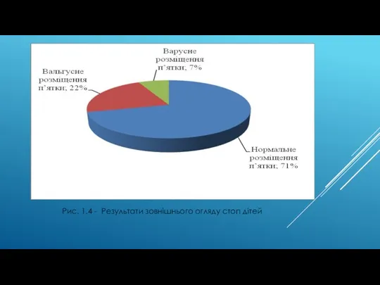 Рис. 1.4 - Результати зовнішнього огляду стоп дітей