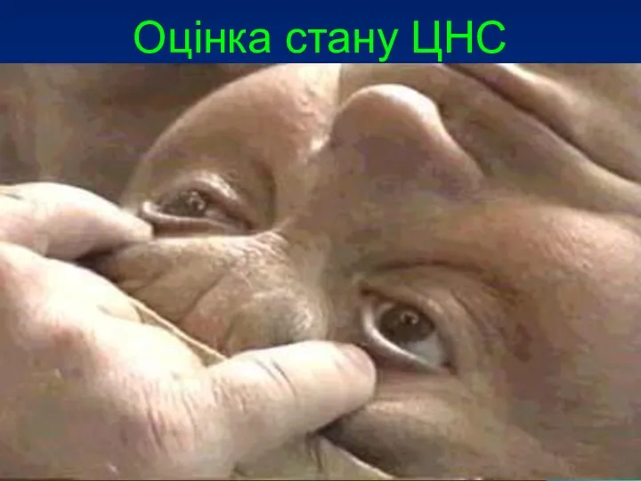 Оцінка стану ЦНС