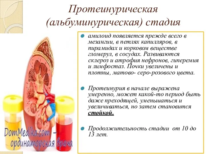 Протеинурическая (альбуминурическая) стадия амилоид появляется прежде всего в мезангии, в