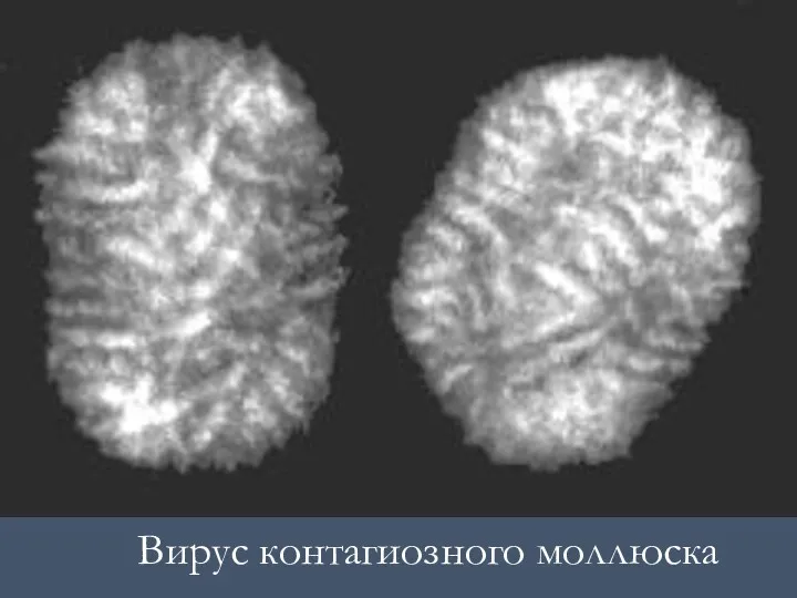 Вирус контагиозного моллюска
