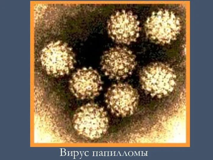 Вирус папилломы