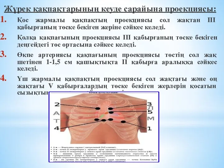 Жүрек қақпақтарының кеуде сарайына проекциясы: Қос жармалы қақпақтың проекциясы сол