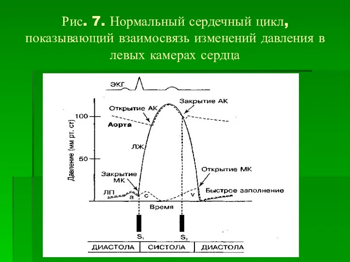 Рис. 7. Нормальный сердечный цикл, показывающий взаимосвязь изменений давления в левых камерах сердца