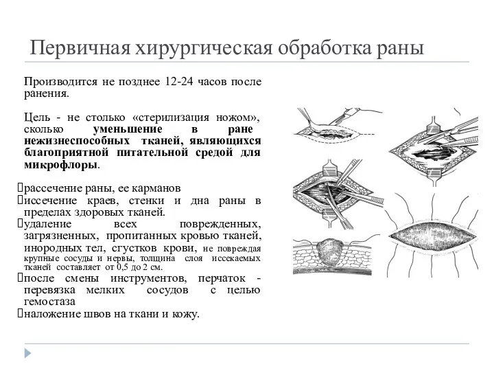 Первичная хирургическая обработка раны Производится не позднее 12-24 часов после