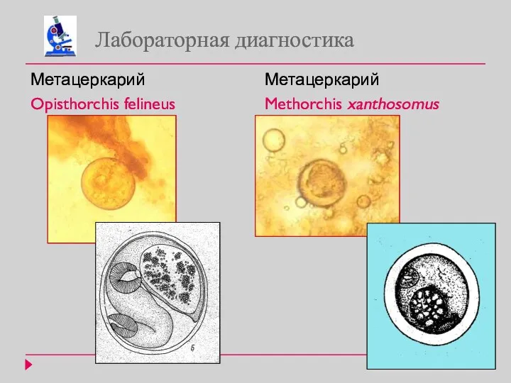 Лабораторная диагностика Метацеркарий Opisthorchis felineus Метацеркарий Methorchis xanthosomus