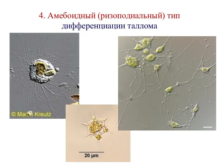 4. Амебоидный (ризоподиальный) тип дифференциации таллома