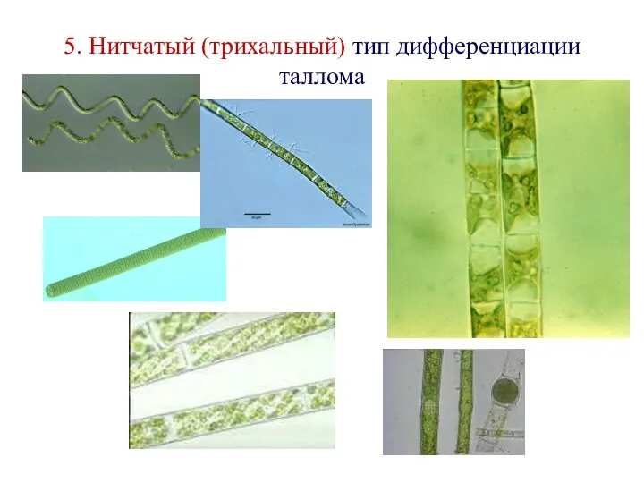 5. Нитчатый (трихальный) тип дифференциации таллома