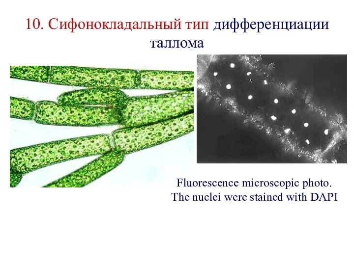 10. Сифонокладальный тип дифференциации таллома Fluorescence microscopic photo. The nuclei were stained with DAPI