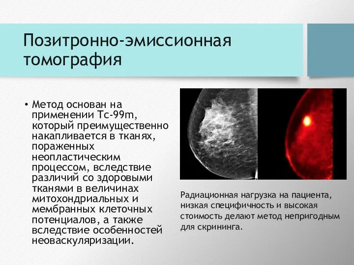 Позитронно-эмиссионная томография Метод основан на применении Tc-99m, который преимущественно накапливается