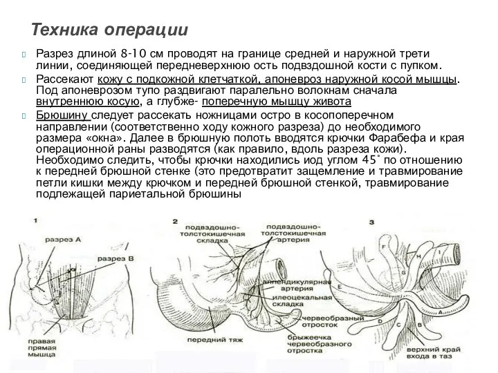 Разрез длиной 8-10 см проводят на границе средней и наружной