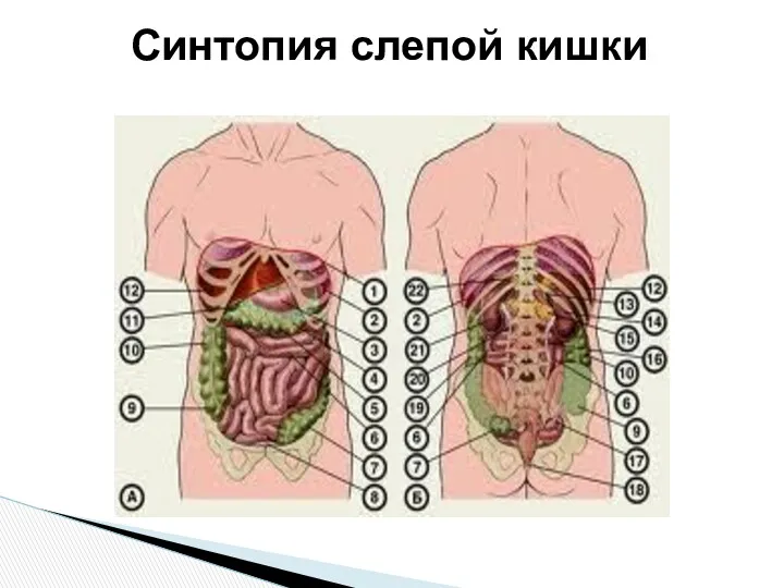 Синтопия слепой кишки