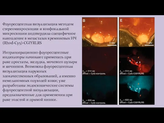 Флуоресцентная визуализация методом стереомикроскопии и конфокальной микроскопии подтвердила специфичное накопление