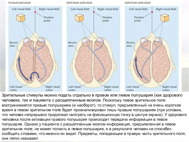 Зрительные стимулы можно подать отдельно в правое или левое полушария