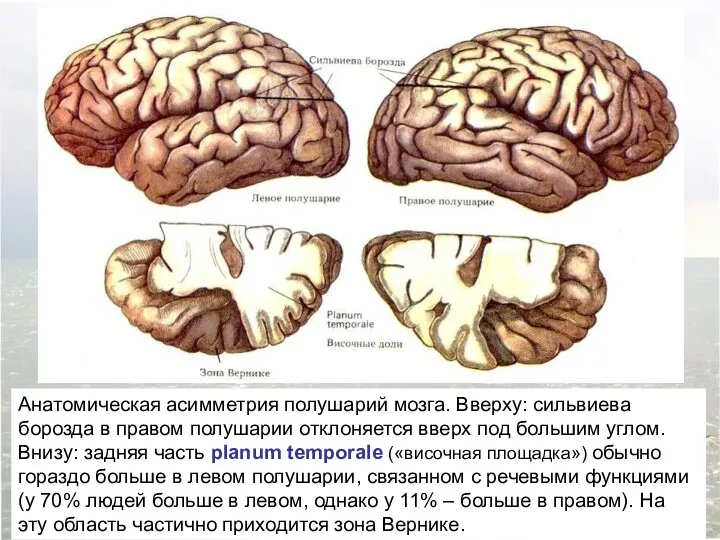 Анатомическая асимметрия полушарий мозга. Вверху: сильвиева борозда в правом полушарии