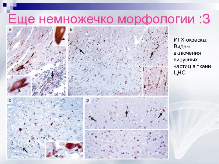 Еще немножечко морфологии :З ИГХ-окраска: Видны включения вирусных частиц в ткани ЦНС