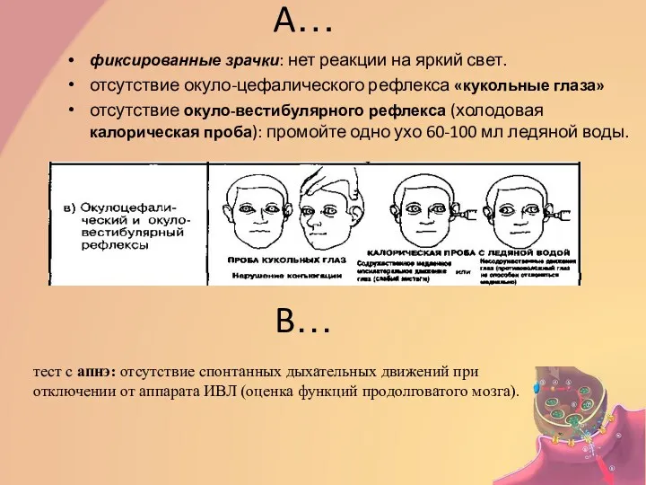 A… фиксированные зрачки: нет реакции на яркий свет. отсутствие окуло-цефалического