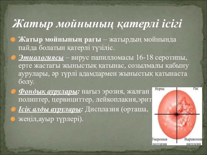 Жатыр мойнының рагы – жатырдың мойнында пайда болатын қатерлі түзіліс.