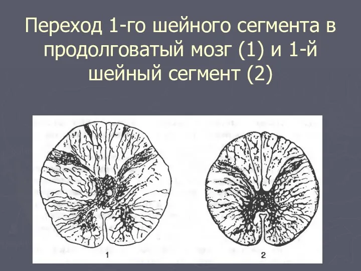 Переход 1-го шейного сегмента в продолговатый мозг (1) и 1-й шейный сегмент (2)