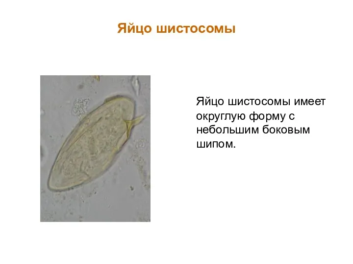 Яйцо шистосомы Яйцо шистосомы имеет округлую форму с небольшим боковым шипом.