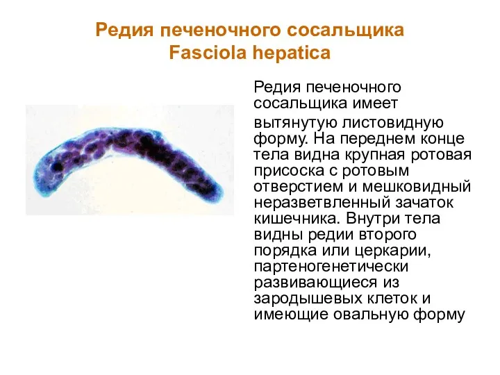 Редия печеночного сосальщика Fasciola hepatica Редия печеночного сосальщика имеет вытянутую