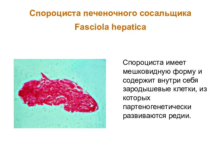 Спороциста печеночного сосальщика Fasciola hepatica Спороциста имеет мешковидную форму и