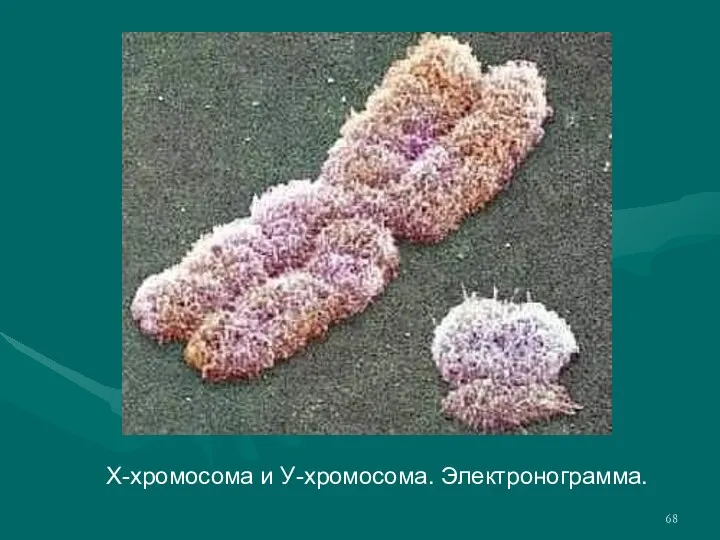 Х-хромосома и У-хромосома. Электронограмма.