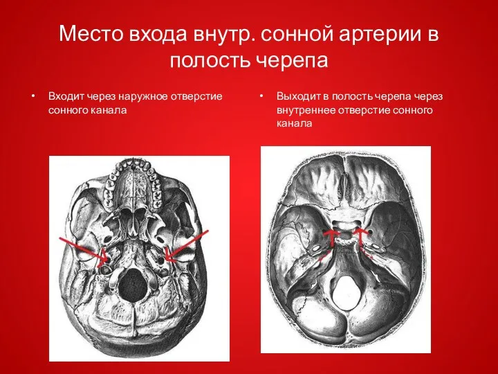 Место входа внутр. сонной артерии в полость черепа Входит через