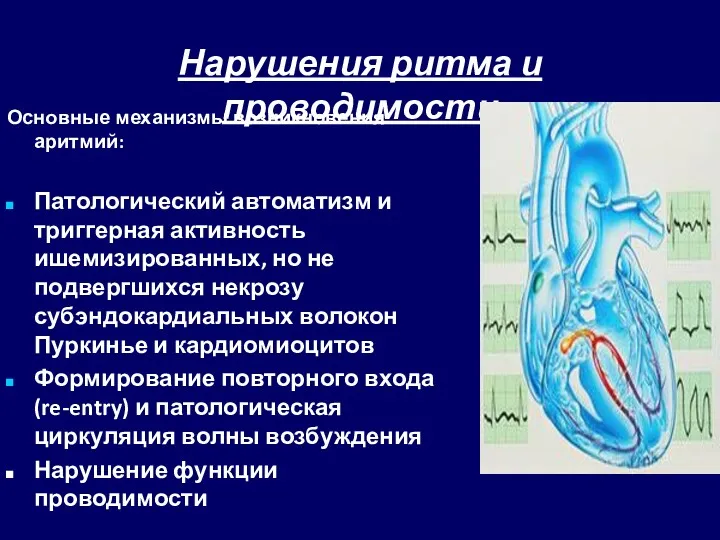 Нарушения ритма и проводимости Основные механизмы возникновения аритмий: Патологический автоматизм