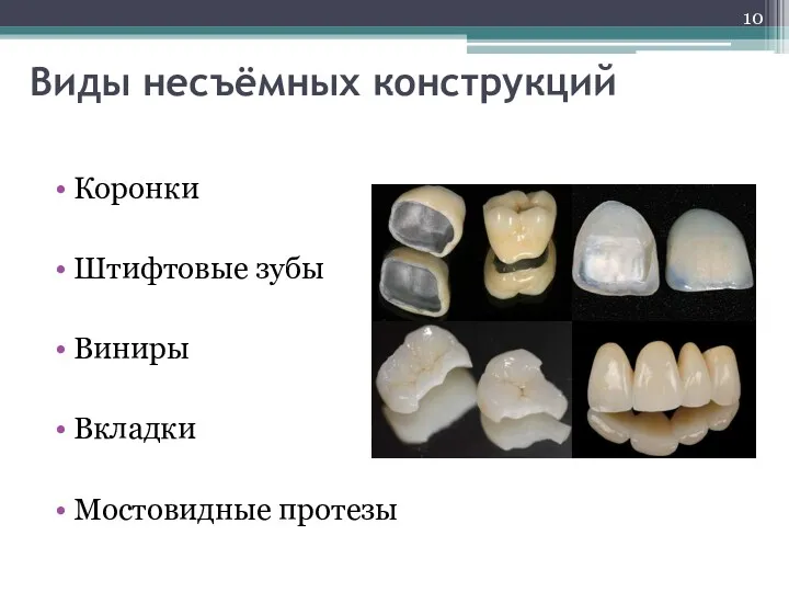 Виды несъёмных конструкций Коронки Штифтовые зубы Виниры Вкладки Мостовидные протезы