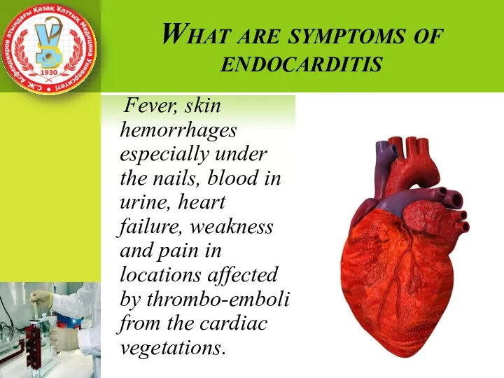 What are symptoms of endocarditis Fever, skin hemorrhages especially under