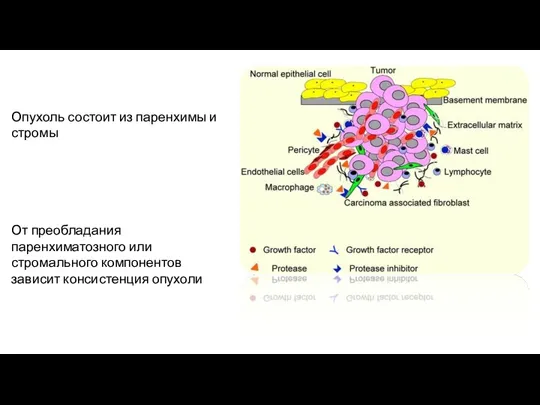 Опухоль состоит из паренхимы и стромы От преобладания паренхиматозного или стромального компонентов зависит консистенция опухоли