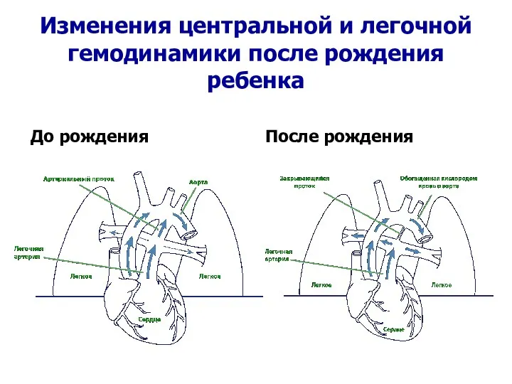 Изменения центральной и легочной гемодинамики после рождения ребенка До рождения После рождения