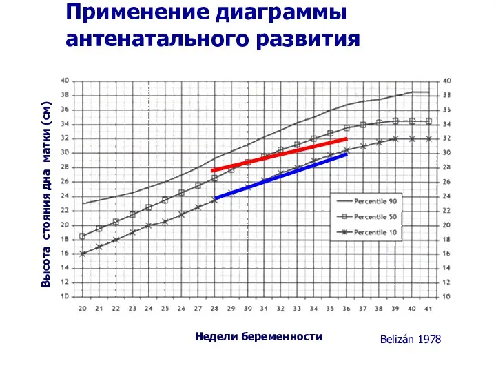 Недели беременности Высота стояния дна матки (см) Применение диаграммы антенатального развития Belizán 1978