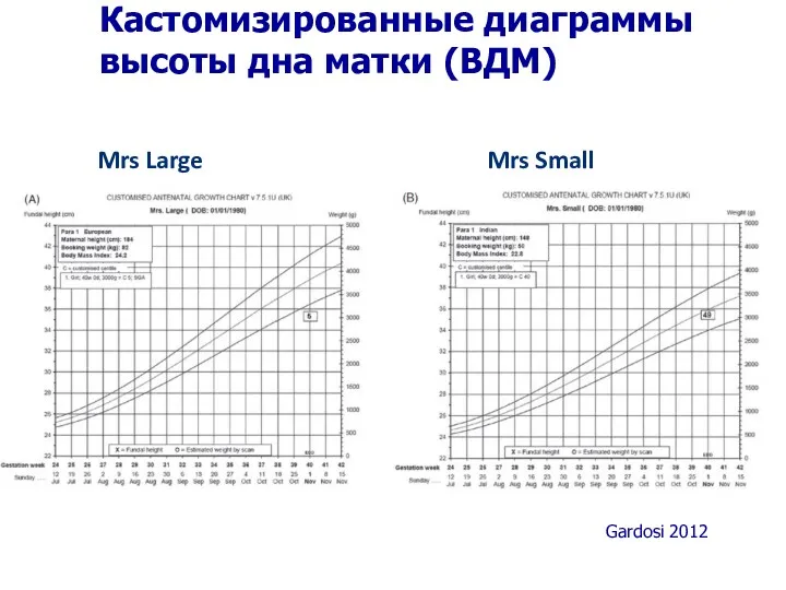 Кастомизированные диаграммы высоты дна матки (ВДМ) Mrs Large Mrs Small Gardosi 2012