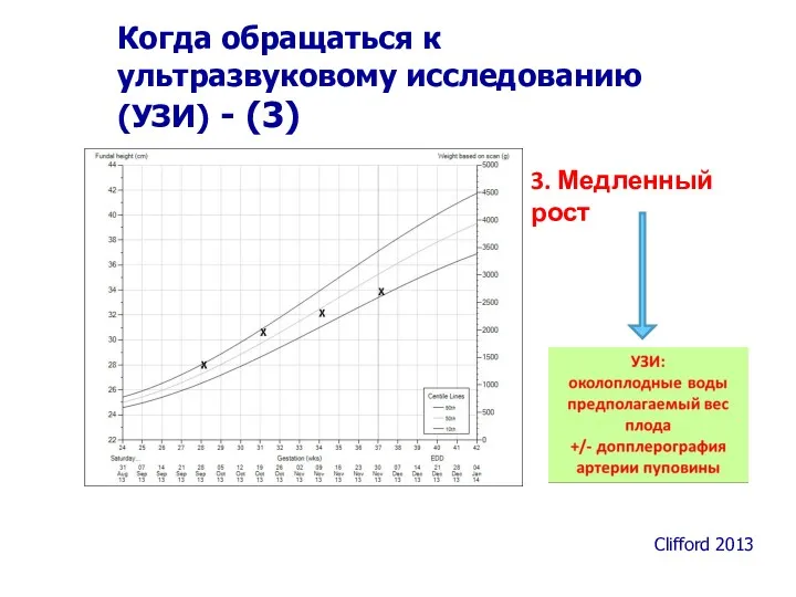 3. Медленный рост Clifford 2013 Когда обращаться к ультразвуковому исследованию (УЗИ) - (3)