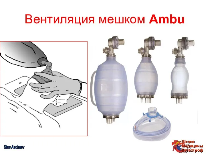 Вентиляция мешком Ambu Stas Aschaev