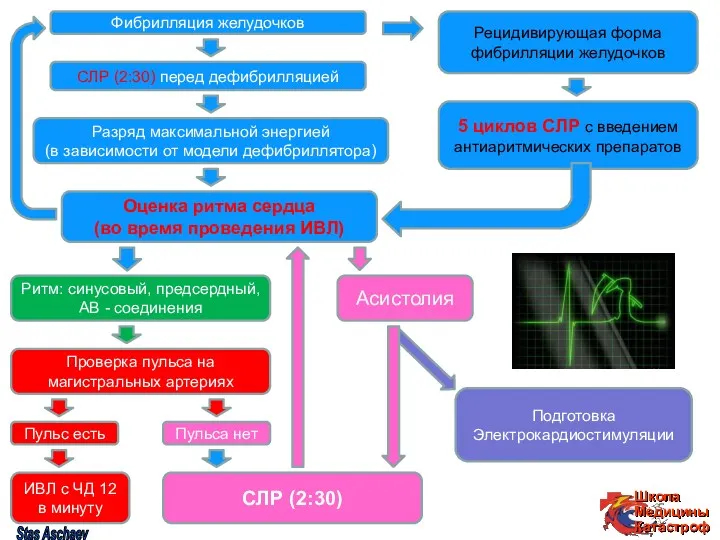 Оценка ритма сердца (во время проведения ИВЛ) Фибрилляция желудочков СЛР