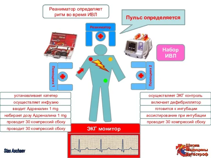 ЭКГ контроль осуществляет ЭКГ контроль Пульс не определяется Реаниматор проводит