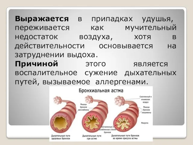 Выражается в припадках удушья, переживается как мучительный недостаток воздуха, хотя