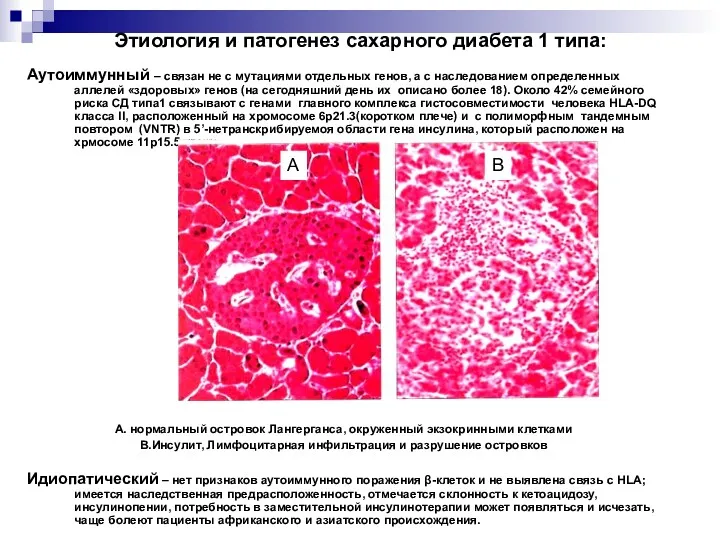 Этиология и патогенез сахарного диабета 1 типа: Аутоиммунный – связан