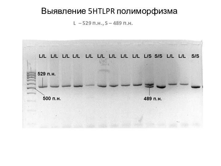 Выявление 5HTLPR полиморфизма L – 529 п.н., S – 489 п.н.