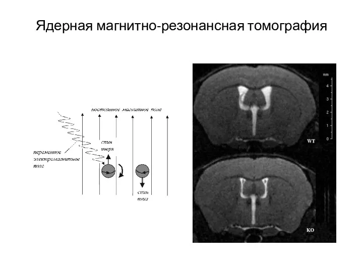 Ядерная магнитно-резонансная томография